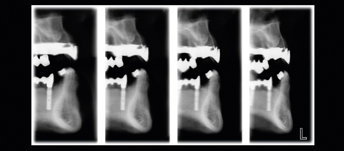 Cross-sectional tomography