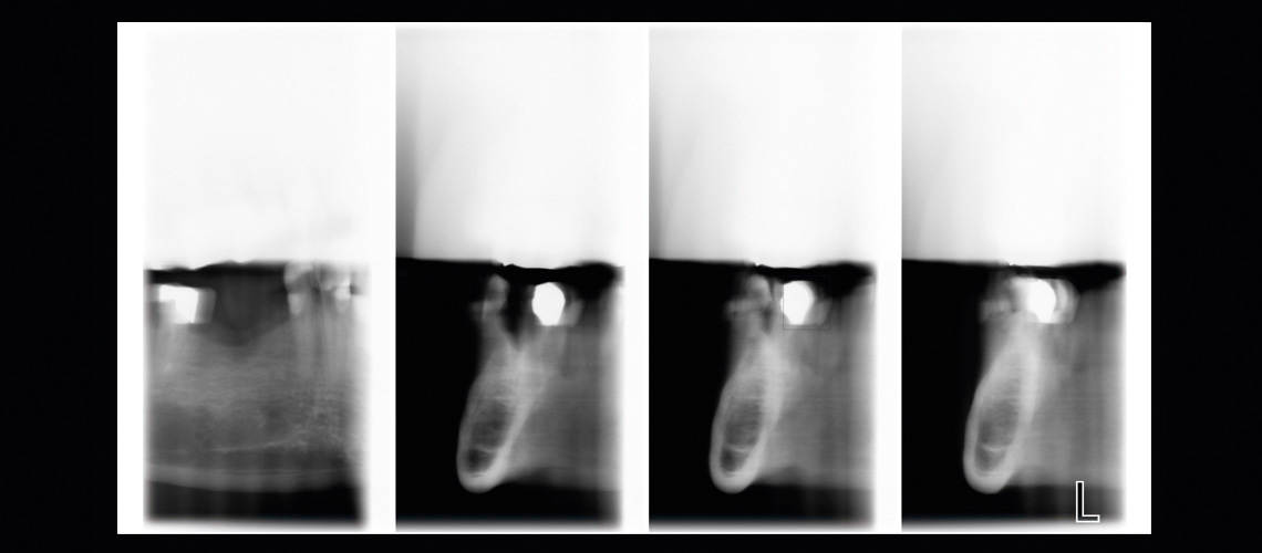 Combined tomography