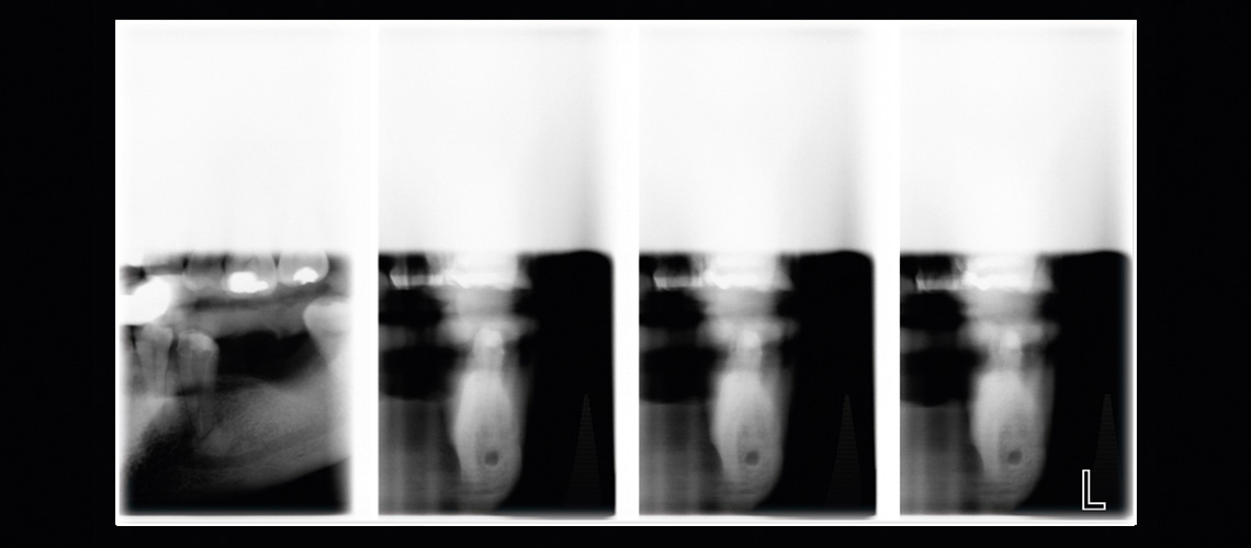 Combined tomography