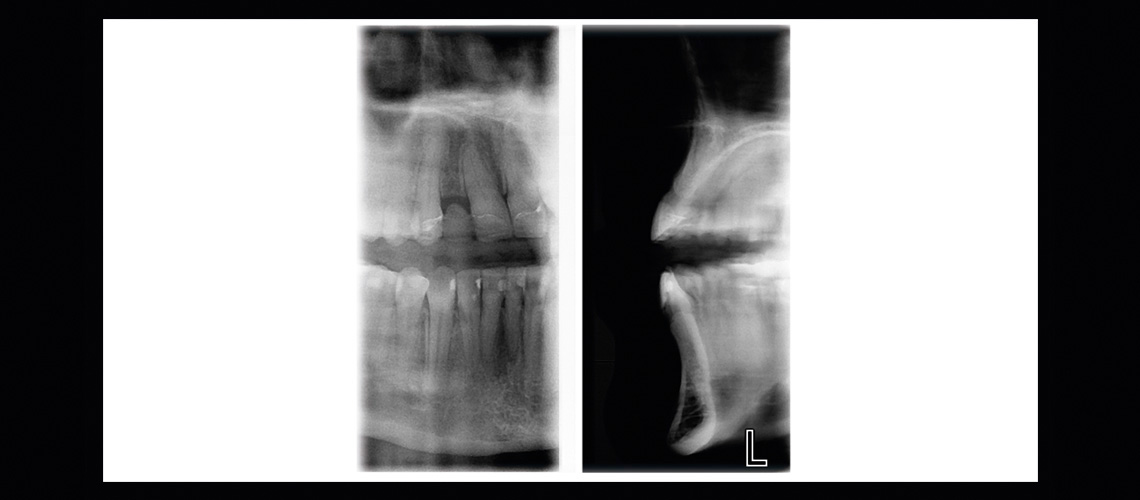 Combined tomography