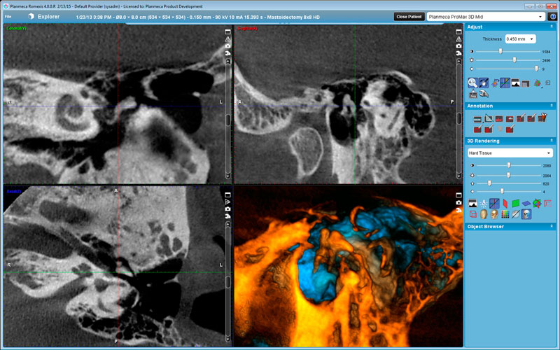 Planmeca ProMax 3D Mid middle ear