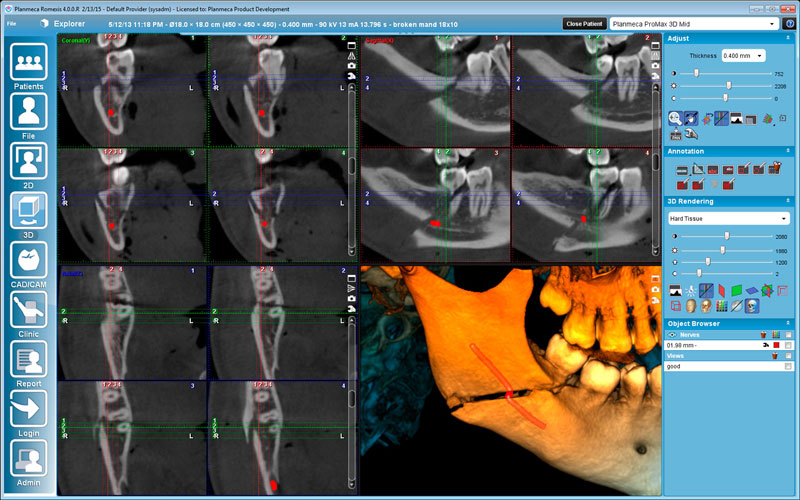 Planmeca ProMax 3D Mid Surgical case