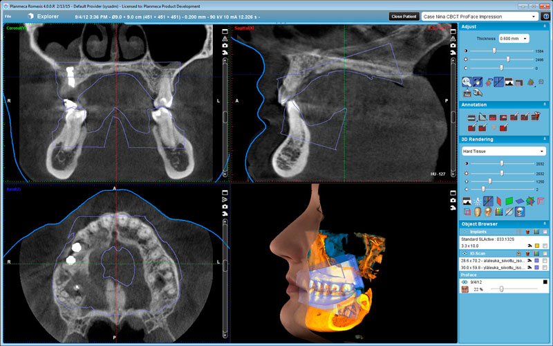 Planmeca ProMax 3D Mid 3x3D