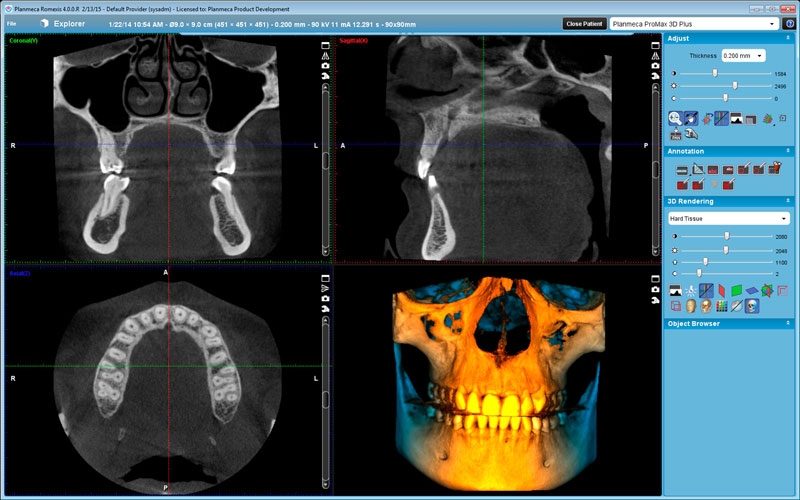 Planmeca ProMax 3D Plus 9x9 volume