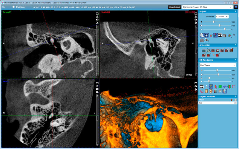 Planmeca ProMax 3D Plus middle ear