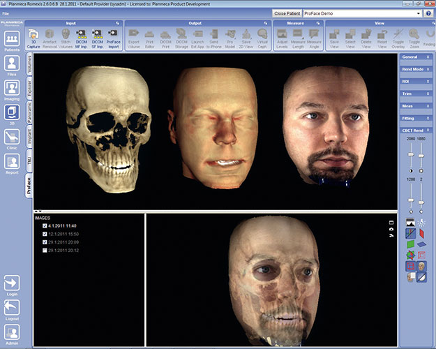 Planmeca Romexis ProFace module