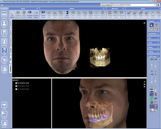 Planmeca Romexis ProFace module