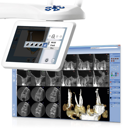 Endodontic imaging mode