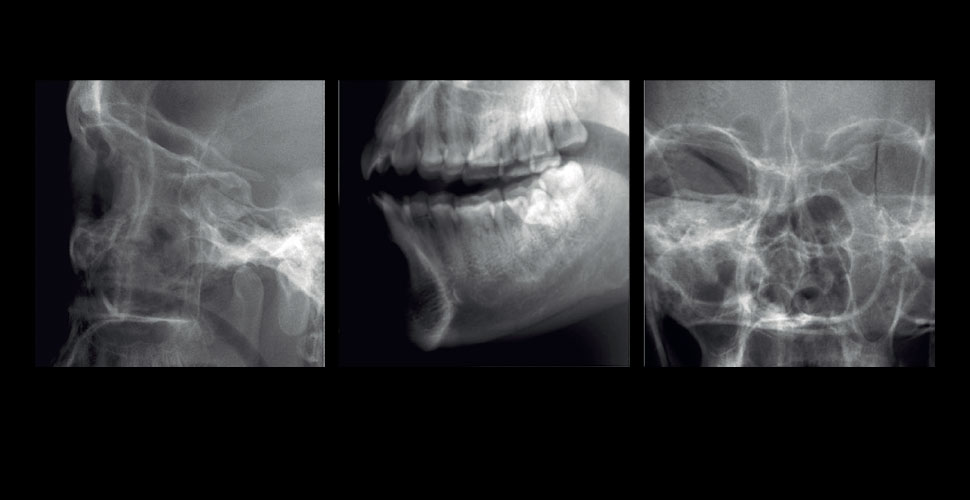 Scout images and 2D views help positioning and can even be used in preliminary diagnosis.