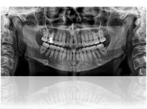 2D imaging