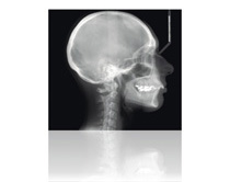 Cephalometry