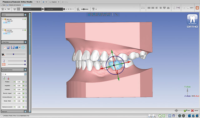 Planmeca Romexis 3D Ortho Studio